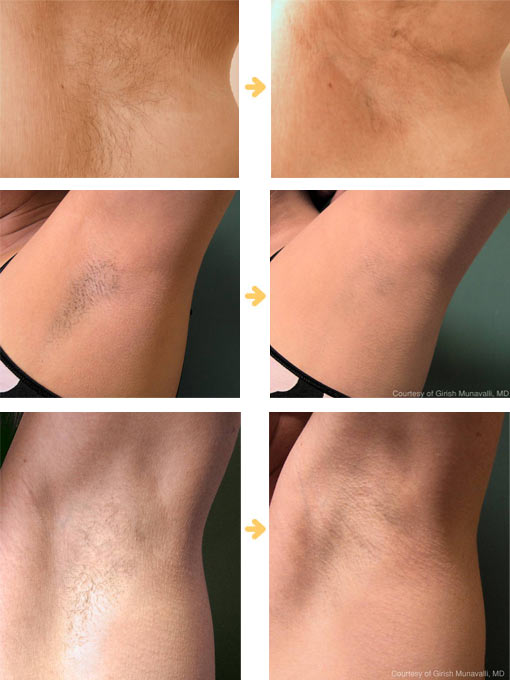 安い医療レーザー脱毛なら 大阪のたにまちクリニックへ 医療法人秀黄会たにまちクリニック